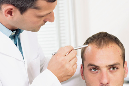 Why Hair Loss Treatments in Dubai Can be Tricky
