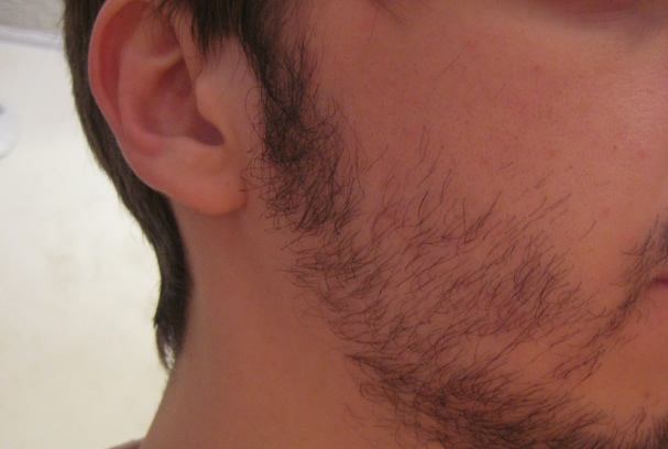 Patchy Beard