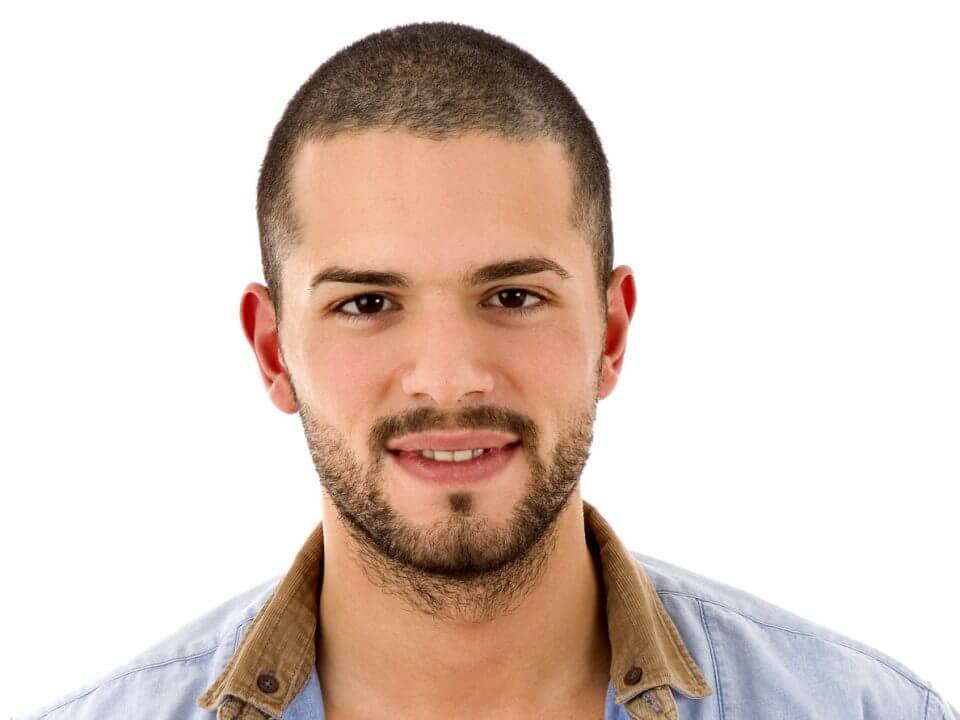 Beard Hair Transplant