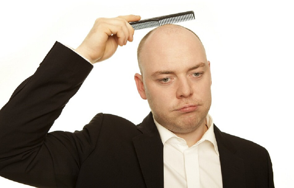 baldness facts and treatment