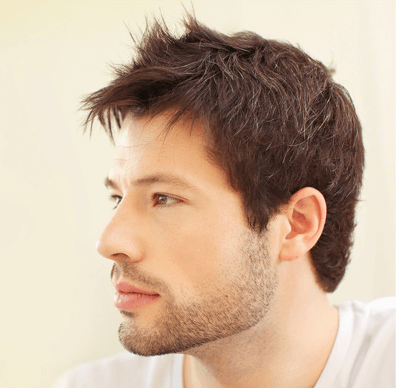 men hair loss treatment in Dubai
