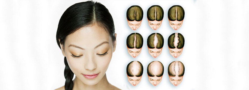 hair restoration for women