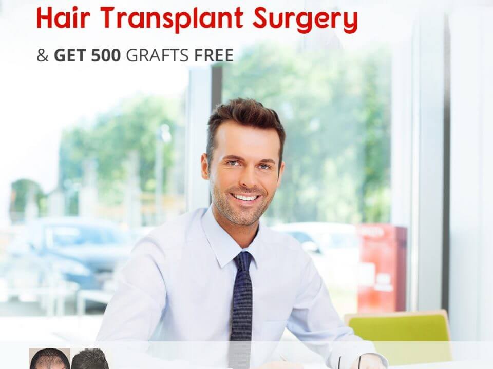 500 grafts free