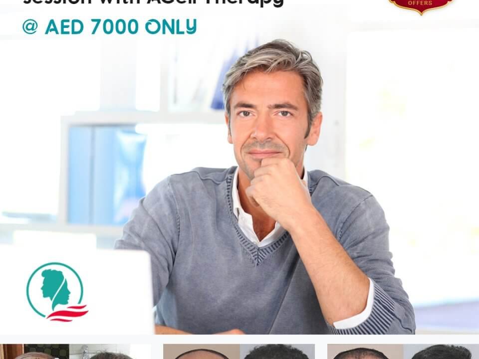 hair loss offer