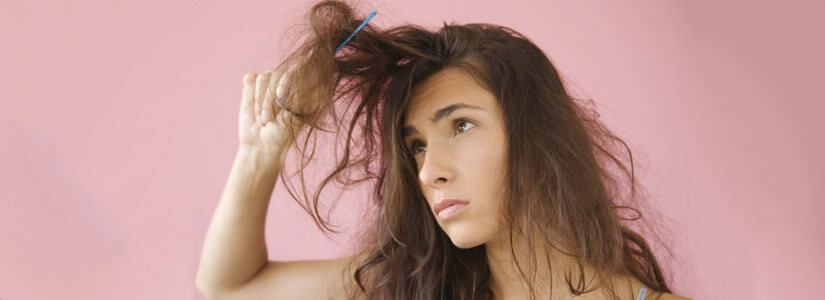 women-hair-loss