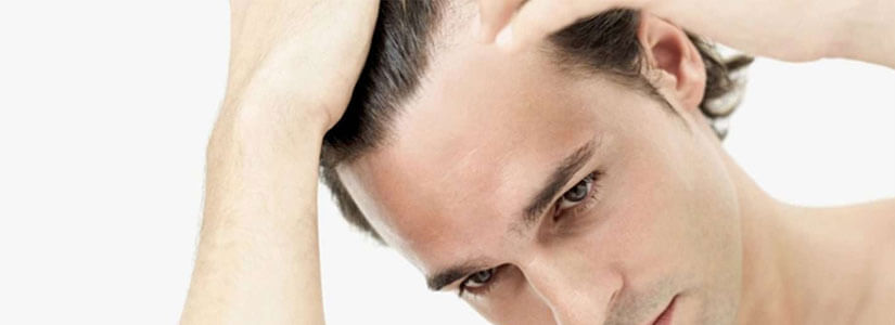 hair-loss-prevention