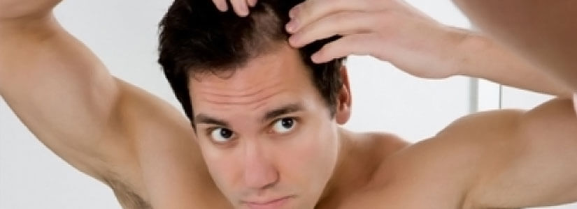 hormonal-hair-loss