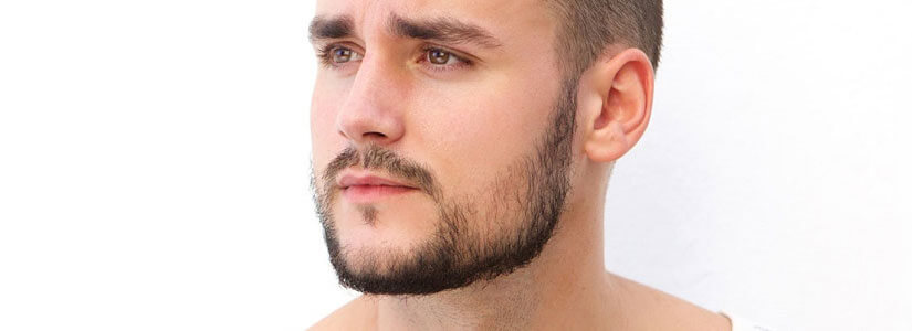 beard-transplant