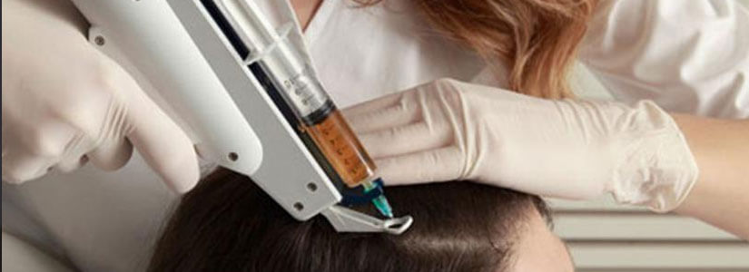 mesotherapy treatment for hair loss in dubai, Abu dhabi