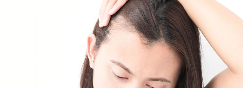 How-much-hair-loss-is-normal-Finding-out-the-triggers-of-hair-loss