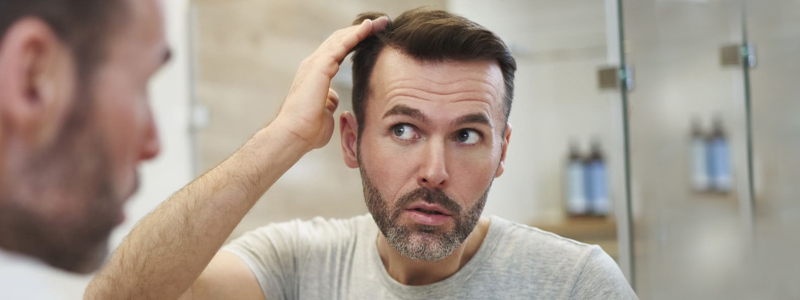 hair-loss-treatment-in-dubai