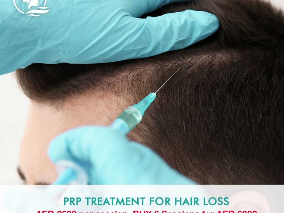 PRP treatment for hair loss in dubai