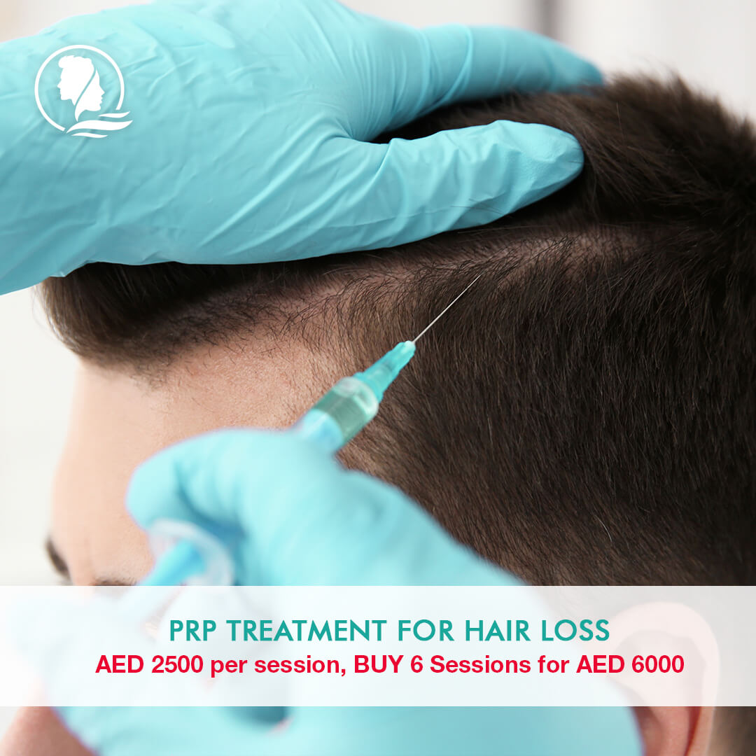 PRP treatment for hair loss in dubai