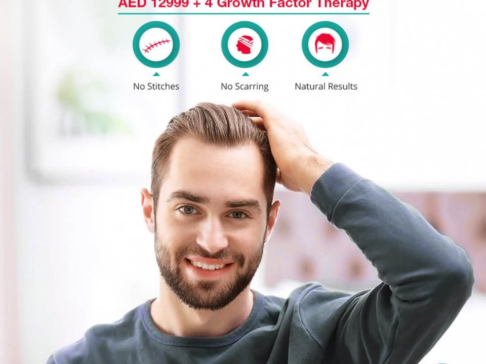 fue hair transplant dubai