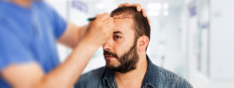 How to Find Right Hair Transplant Surgeon in Dubai & Abu Dhabi?