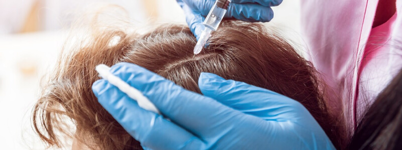 Hair Loss Get You Down? Will PRP Regrow Your Hair? Facts You May Know
