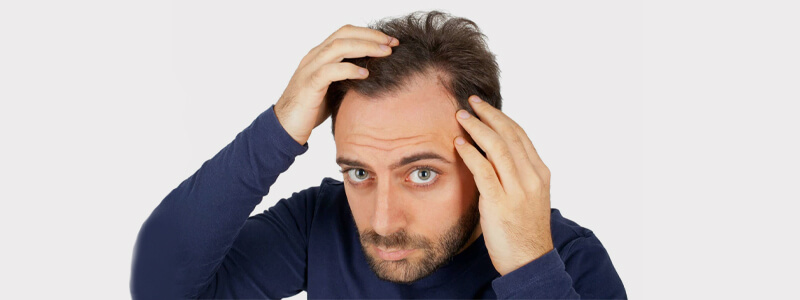 Does Dandruff Cause Hair Loss - How to Stop?