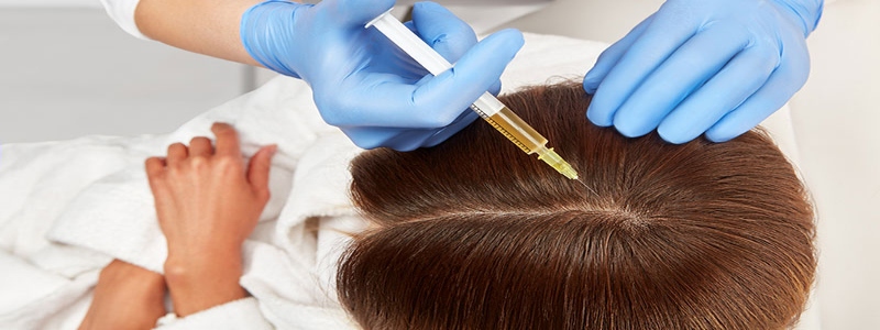 Mesotherapy for hair regrowth in Dubai