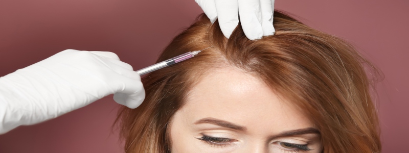 Mesotherapy for hair fall