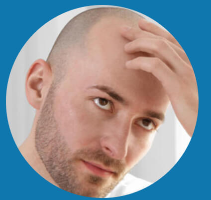 Customer Testimonials and Reviews About Hair Transplant