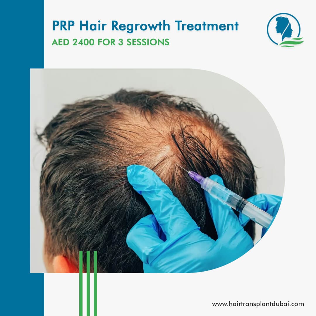 PRP hair regrowth offer