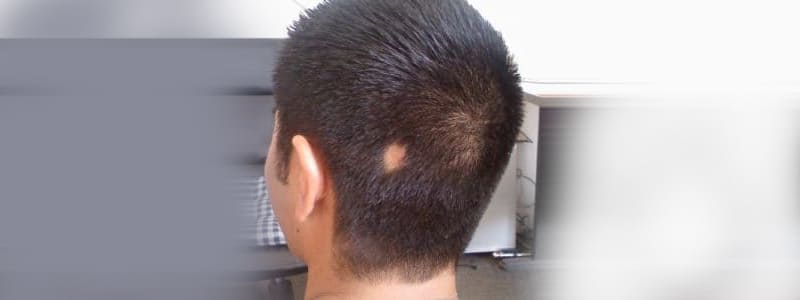 What Causes Hairless Spots on the Scalp? | Hair Transplant Dubai