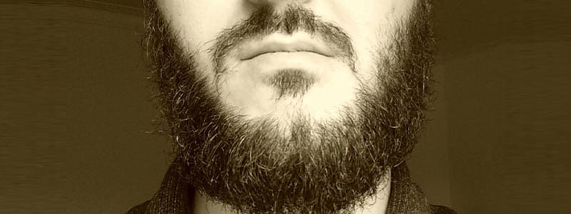 Beard-transplant1