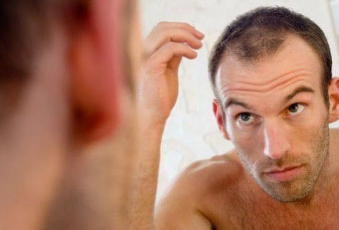 hair loss treatment in dubai