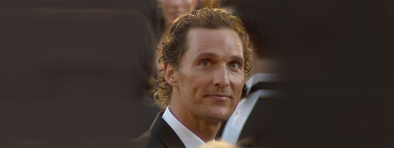 Matthew-McConaughey Hair Transplant