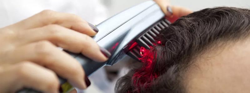 Laser hair therapy in dubai