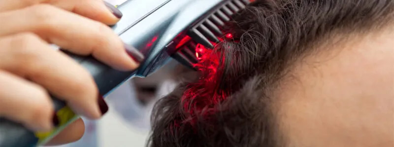 Laser Hair Loss Therapy