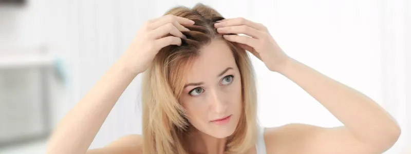 Female Hair Loss Treatment Cost